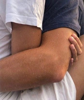 A cover of "SKIN" cluster. The owner is maizieray. The cluster consists of 10 elements.