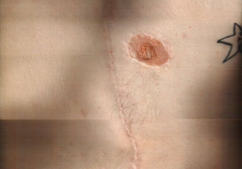 A cover of "skin" cluster. The owner is alyxxsmith. The cluster description is "human skin and bodies". The cluster consists of 135 elements.