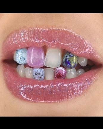 A cover of "teeth" cluster. The owner is sashagembess. The cluster consists of 6 elements.