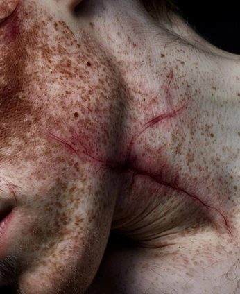 A cover of "degratation" cluster. The owner is gffhf. The cluster consists of 89 elements.