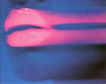 A cover of "BG" cluster. The owner is privatearson. The cluster consists of 20 elements.