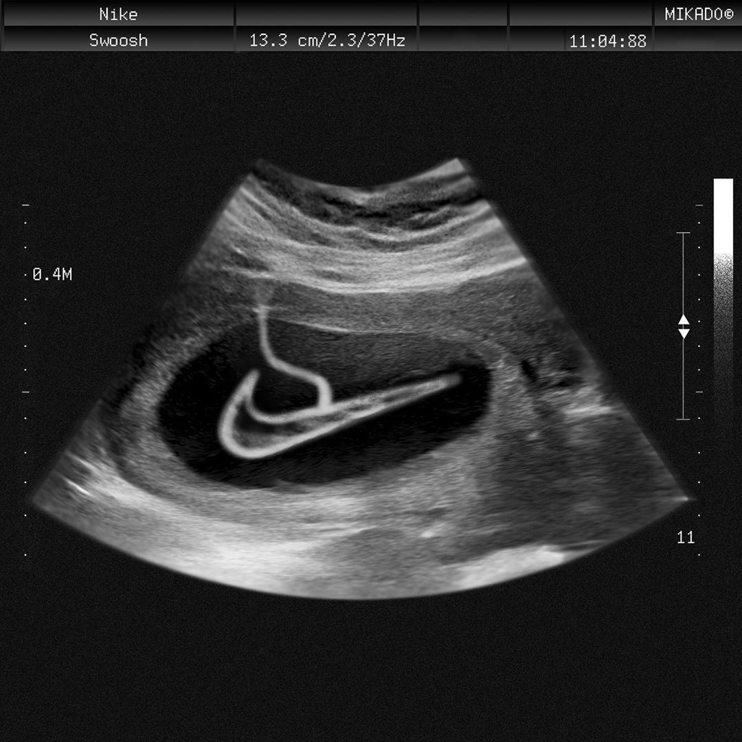 Conceptual artwork by Mikaël Barelaud Eludut depicting a Nike Swoosh in an ultrasound.