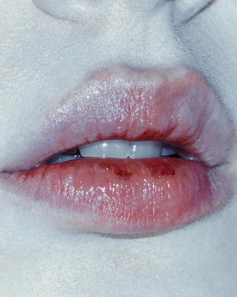 A cover of "brain rot" cluster. The owner is babysbreath. The cluster consists of 8 elements.