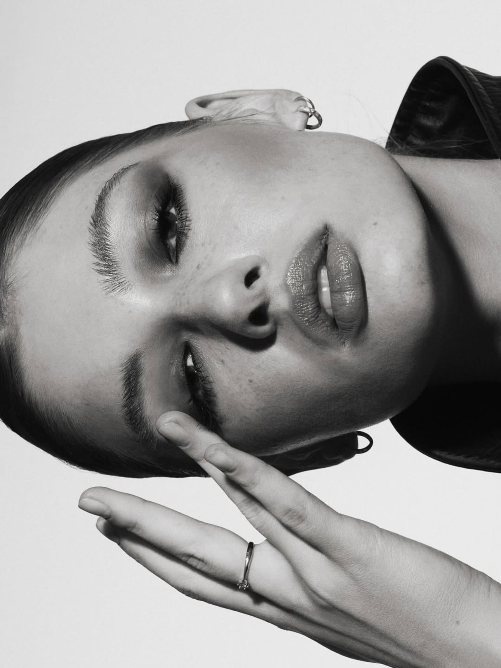 SKIN — 5