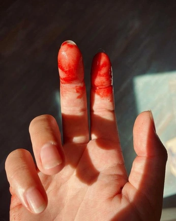 A cover of "Jessie Menstrual Shoot" cluster. The owner is oliviiallee. The cluster consists of 8 elements.