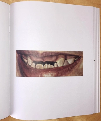 A cover of "tooth" cluster. The owner is aanniiee. The cluster consists of 3 elements.