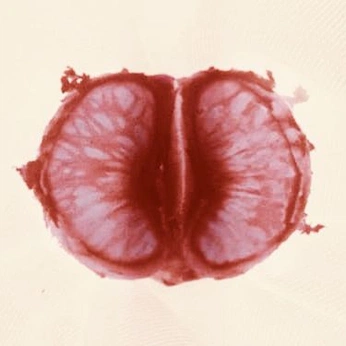 A cover of "Endolife" cluster. The owner is juanitapardog. The cluster consists of 4 elements.