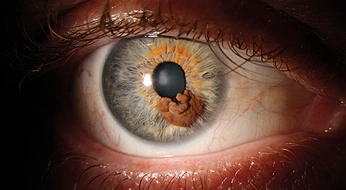 A cover of "👁️" cluster. The owner is karla212. The cluster consists of 56 elements.