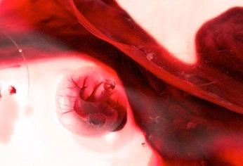 A cover of "pantys" cluster. The owner is barbarasouza. The cluster consists of 9 elements.