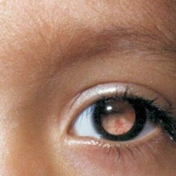 A cover of "olhar" cluster. The owner is icky01. The cluster consists of 58 elements.