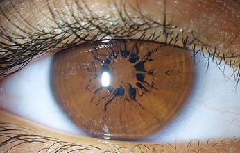 A cover of "Crs" cluster. The owner is silla3000. The cluster consists of 19 elements.