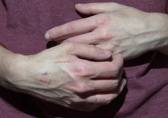 A cover of "hands" cluster. The owner is zombigirl. The cluster consists of 78 elements.