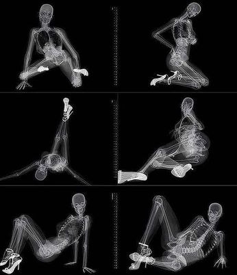 A cover of "Optoteca[[mal.ism]]" cluster. The owner is cosimosportinari. The cluster consists of 192 elements.
