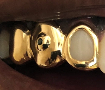 A cover of "BLAF" cluster. The owner is planet58. The cluster consists of 8 elements.