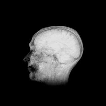 A cover of "NEURO" cluster. The owner is dinizfruhling. The cluster consists of 38 elements.
