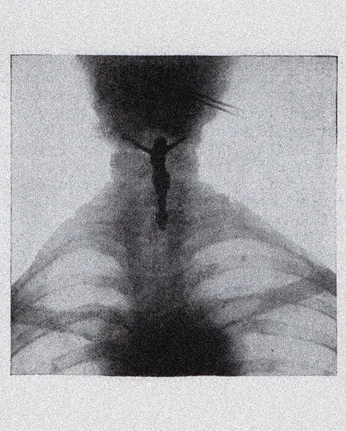 A cover of "xray" cluster. The owner is newuser1. The cluster consists of 4 elements.