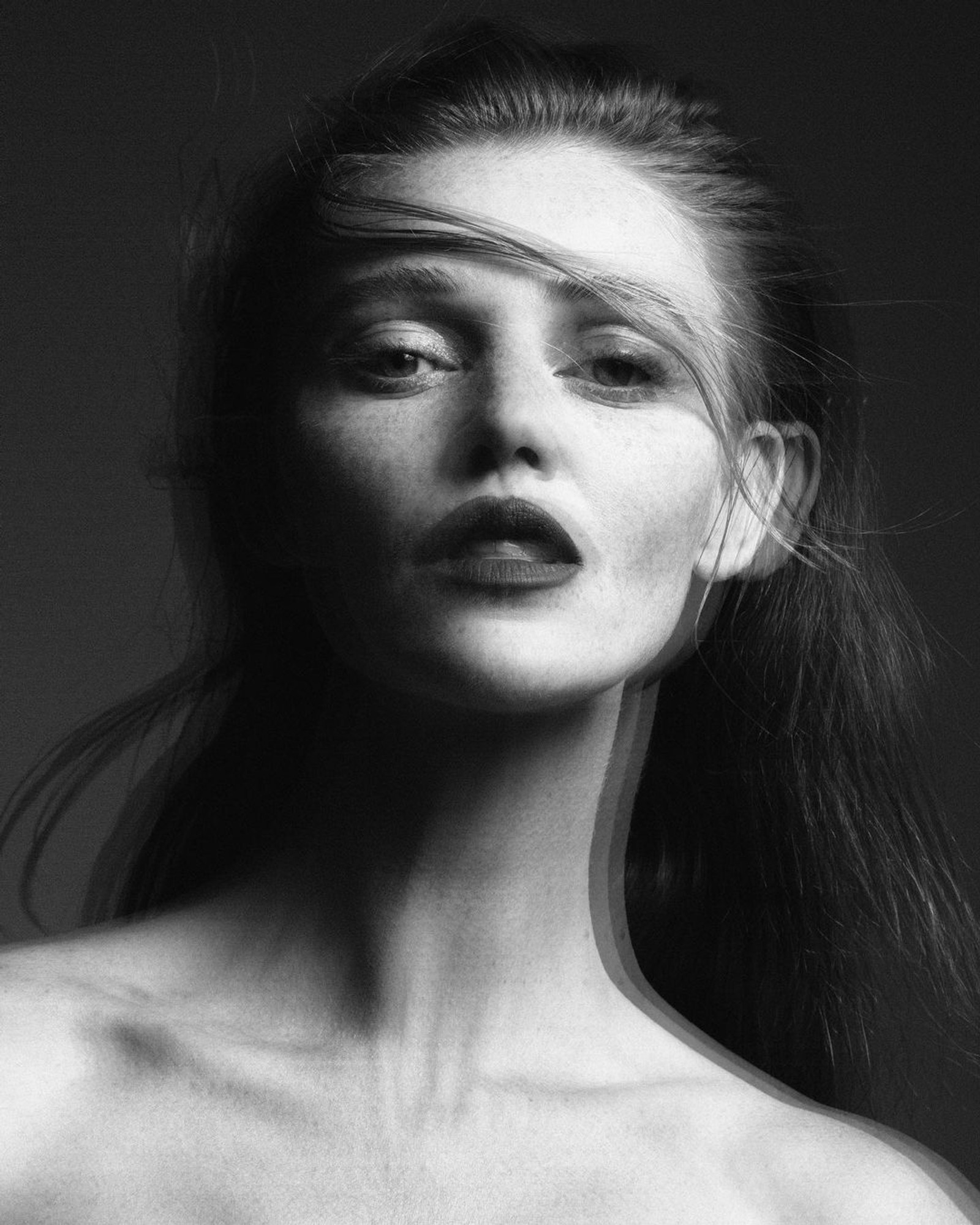 SKIN — 3