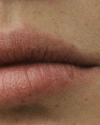 A cover of "SKIN" cluster. The owner is iiiiiiiris.tw. The cluster consists of 3 elements.