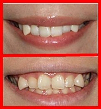 A cover of "claims" cluster. The owner is corpseprize. The cluster consists of 16 elements.