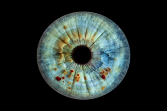 A cover of "Невусы" cluster. The owner is irismoscow. The cluster description is "Родинки в ваших глазах!". The cluster consists of 13 elements.