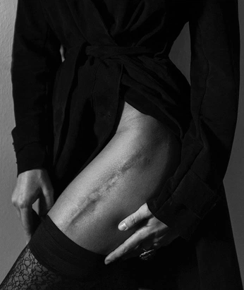 A cover of "Scars" cluster. The owner is ezaffa. The cluster consists of 2 elements.