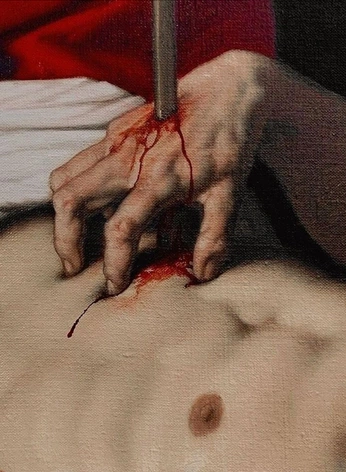 A cover of "wounded" cluster. The owner is luceyn. The cluster consists of 1 element.