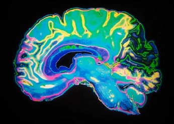 A cover of "brains" cluster. The owner is kellykerin. The cluster consists of 13 elements.