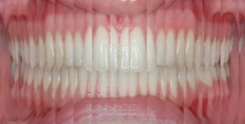 A cover of "!" cluster. The owner is sintetica. The cluster consists of 3 elements.