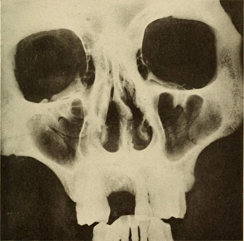 A cover of "HHVN // assets and inspo" cluster. The owner is heartshaven. The cluster consists of 3 elements.