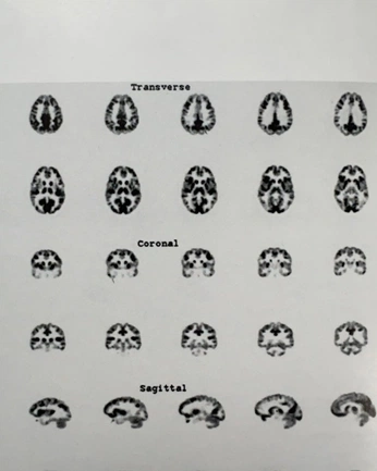 A cover of "brain" cluster. The owner is scarlettbutler7. The cluster consists of 9 elements.