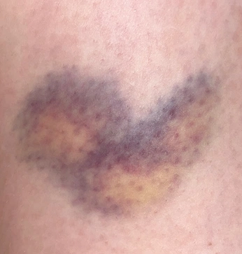 A cover of "Scars" cluster. The owner is vsgr2010. The cluster consists of 5 elements.