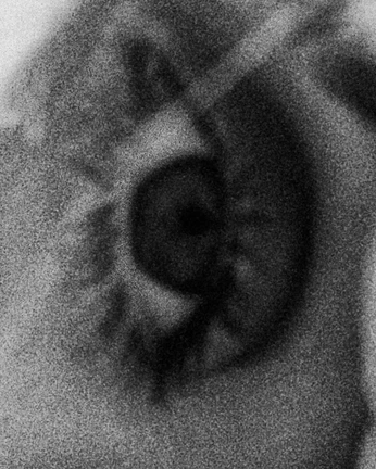 A cover of "Insta" cluster. The owner is silversoul. The cluster consists of 1 element.