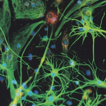 A cover of "Robots/humans" cluster. The owner is mariiaz. The cluster consists of 81 elements. 3 create it.