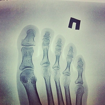 A cover of "Ordinario no ordinario" cluster. The owner is danytrejo. The cluster consists of 9 elements.