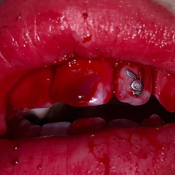 A cover of "Bloody Shoot" cluster. The owner is pureblue. The cluster consists of 50 elements.