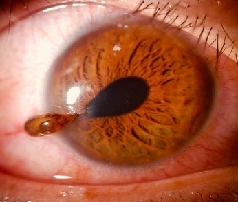 A cover of "Eyes" cluster. The owner is svanilla. The cluster consists of 5 elements.