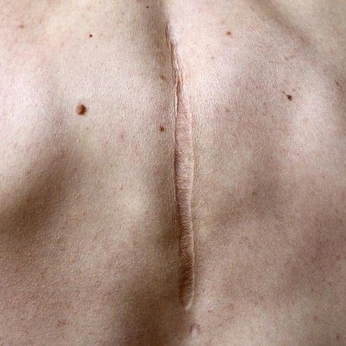 A cover of "for life (cicatrice)" cluster. The owner is miroslavfilm. The cluster consists of 6 elements.