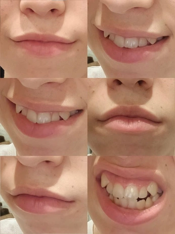 A cover of "art reference" cluster. The owner is jamins. The cluster consists of 3 elements.