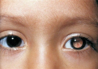 A cover of "humanityy" cluster. The owner is hamsuckle. The cluster consists of 107 elements.